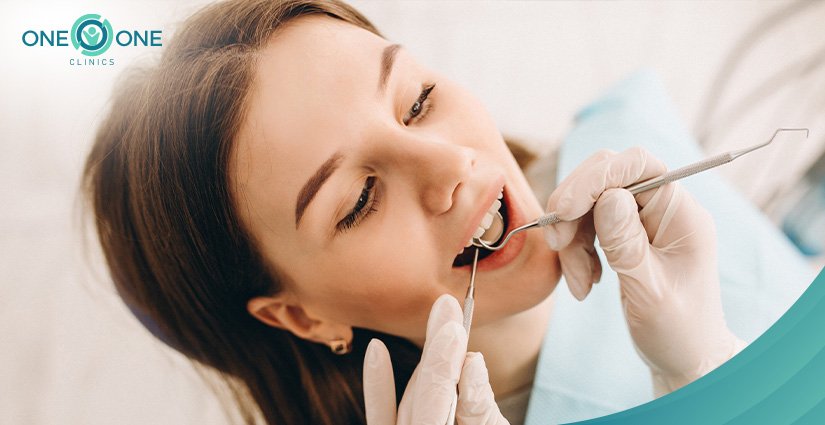 dental bridge cost